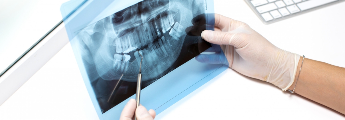 dentist-examines-x-ray-photo-teeths